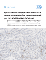 Roche BenchMark XT/LT Interpretation Guide